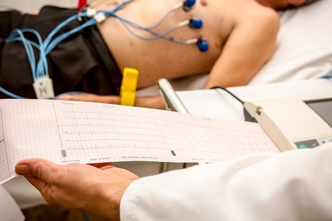 EKG Practice Strips Demystified: Unlocking the Puzzle